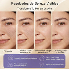 Máscara Facial LED — Terapia Profesional