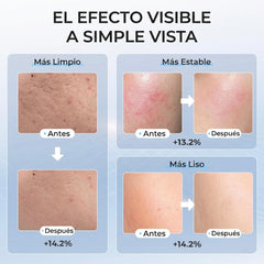 Máscara Facial LED — Terapia Profesional